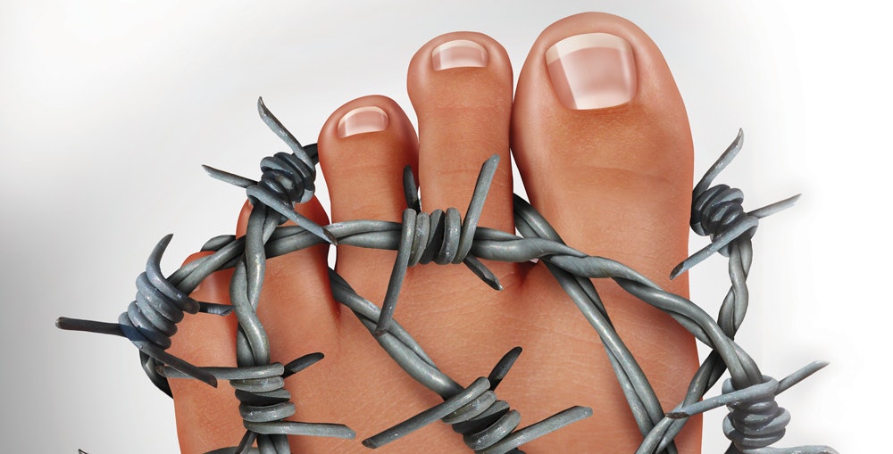 Managing Calluses and Ingrown Nails Effectively
