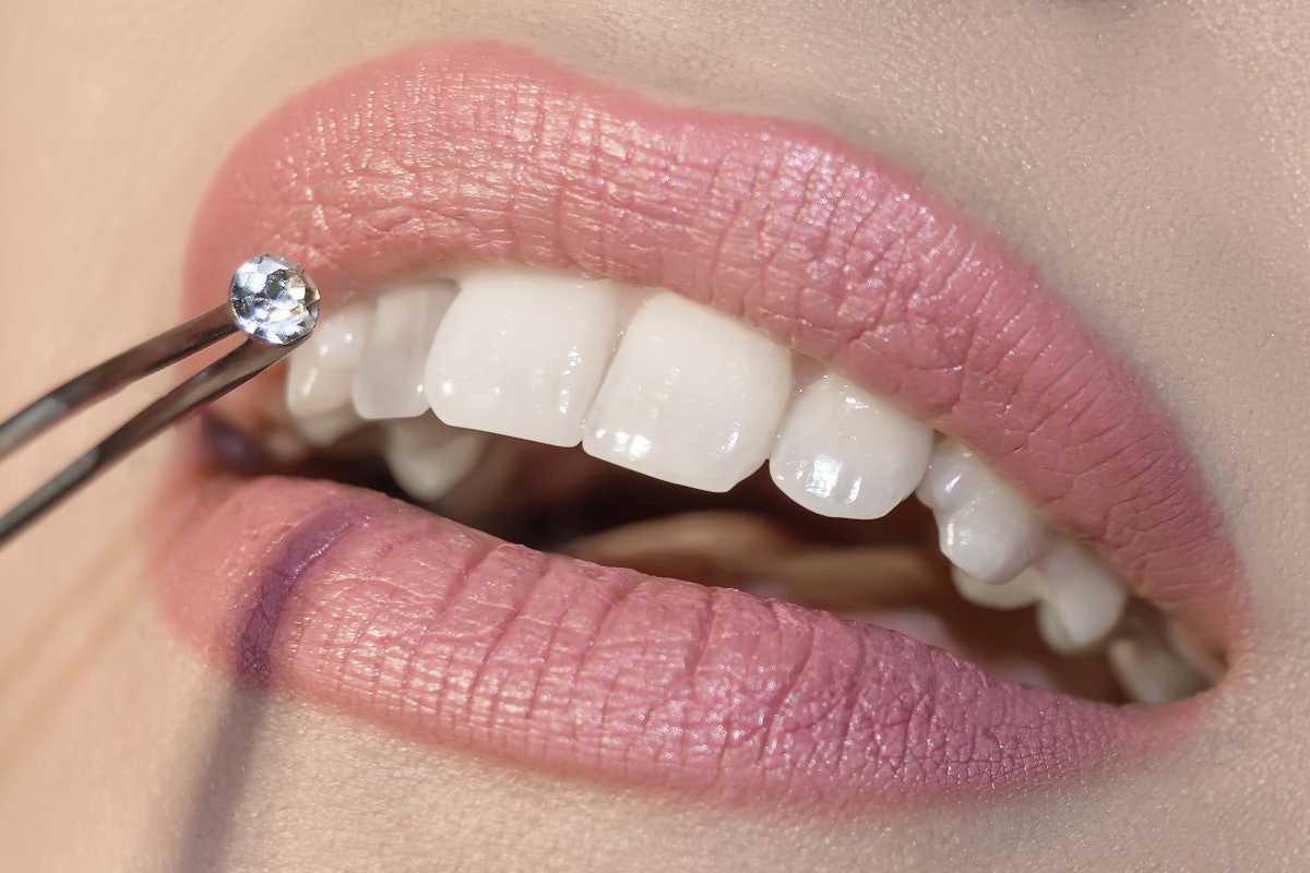 Do You Offer Tooth Gem Services at Your Salon?